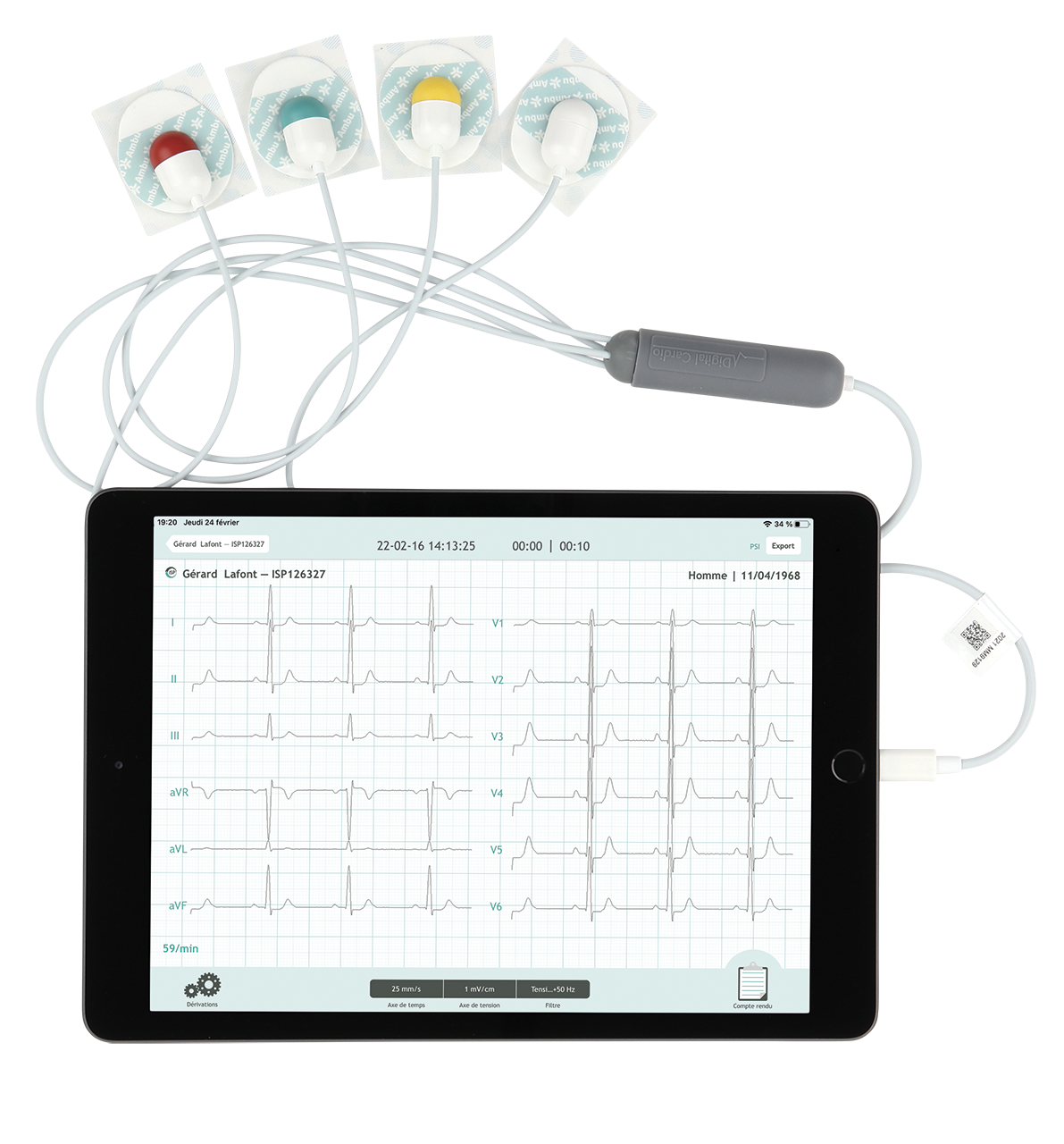 Dispositif Digital Cardio : tablette avec application ECG et câble électrodes 4 dérivations